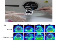 PET-CT diagram