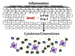 inflammation