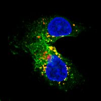 Glycoproteins are shown in green, and yellow spots indicate the glycoproteins located in the Golgi