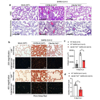CLEC5A and TLR2 are critical in SARS-CoV-2-induced NET formation and lung inflammation