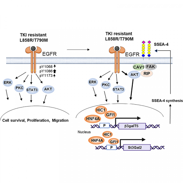 Increased expression of SSEA-4 on TKI-resistant non-small cell lung cancer with EGFR-T790M mutation