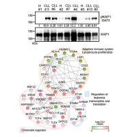 Phosphoproteomics reveals the role of constitutive KAP1 phosphorylation by B-cell receptor signaling in chronic lymphocytic leukemia