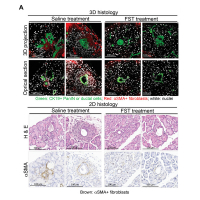 Oncogenic KRAS, Mucin 4, and Activin A-Mediated Fibroblast Activation Cooperate for PanIN Initiation