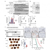 Characterization of initial key steps of IL-17 receptor B oncogenic signaling for targeted therapy of pancreatic cancer