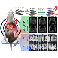 Magnetically Guided Theranostics: Montmorillonite-Based Iron/Platinum Nanoparticles for Enhancing in Situ MRI Contrast and Hepatocellular Carcinoma Treatment