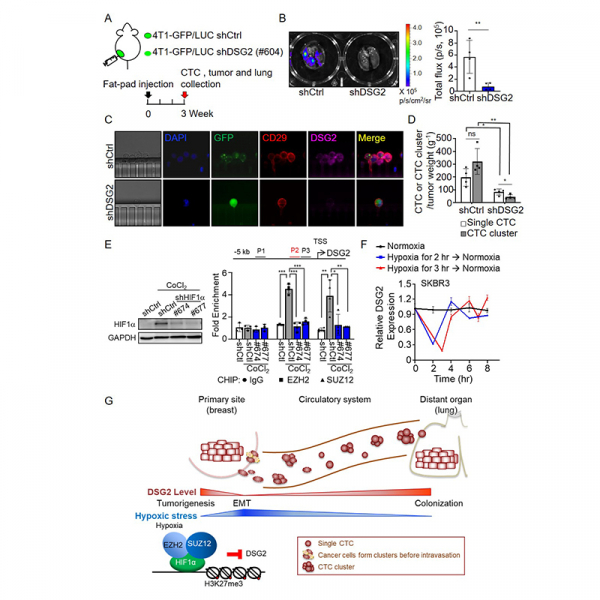 Interplay between desmoglein2 and hypoxia controls metastasis in breast cancer