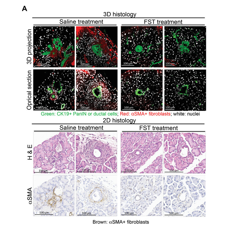 Oncogenic KRAS, Mucin 4, and Activin A-Mediated Fibroblast Activation Cooperate for PanIN Initiation Oncogenic KRAS, Mucin 4, and Activin A-Mediated Fibroblast Activation Cooperate for PanIN Initiation
