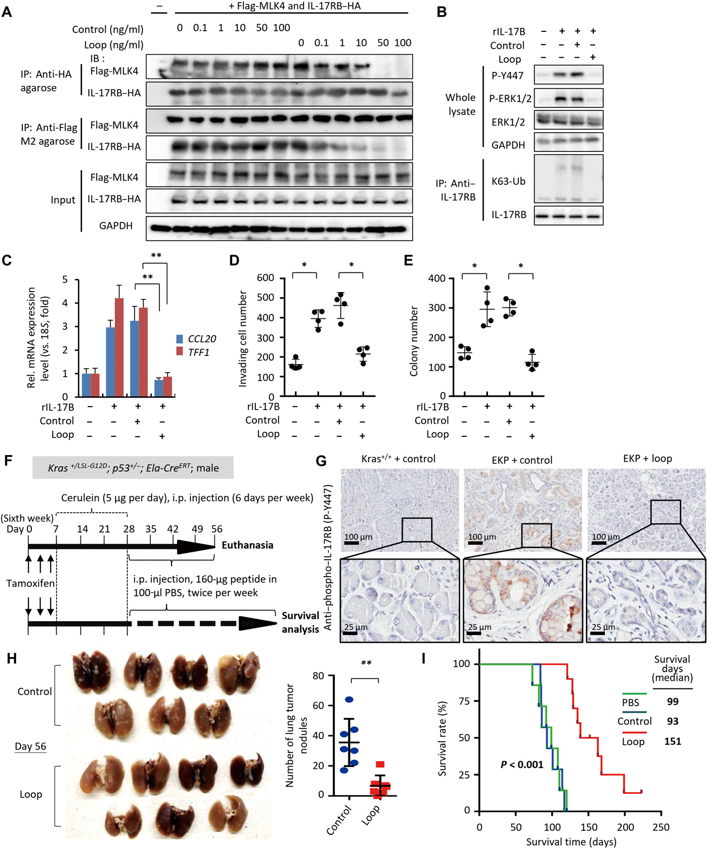 Characterization of initial key steps of IL-17 receptor B oncogenic signaling for targeted therapy of pancreatic cancer Characterization of initial key steps of IL-17 receptor B oncogenic signaling for targeted therapy of pancreatic cancer