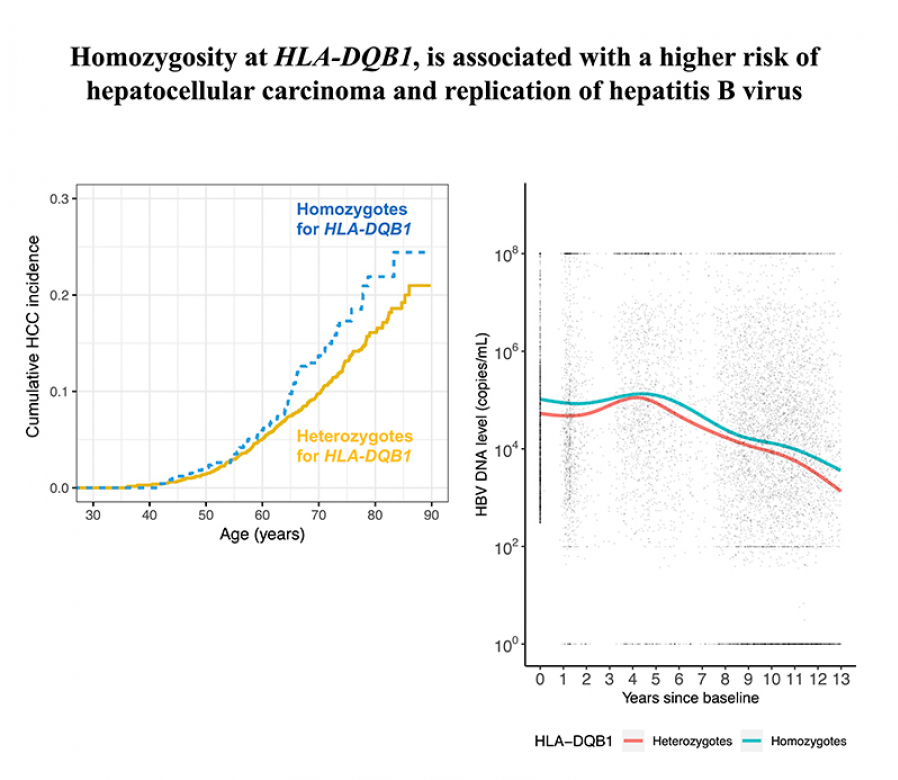 HLA zygosity increases risk of hepatitis B virus-associated hepatocellular carcinoma HLA zygosity increases risk of hepatitis B virus-associated hepatocellular carcinoma
