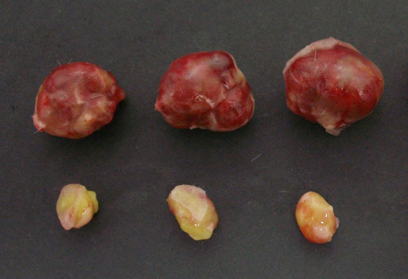 tumor growth
