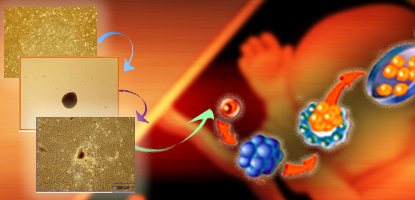 Glycosphingolipid Profile on the Surface of Human Embryonic Stem Cell Identified