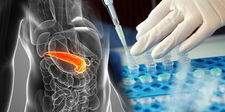 Antibody targeting IL-17B/RB proved effective for pancreatic cancer
