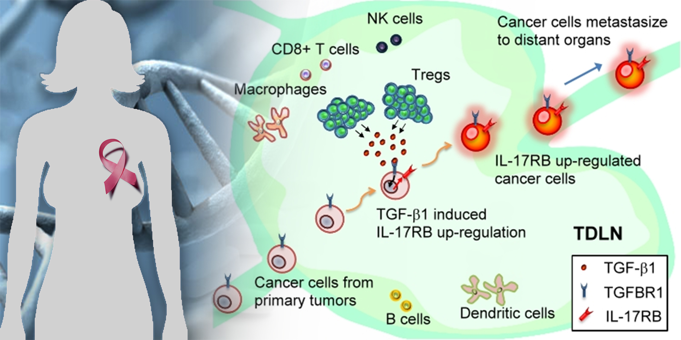 Breast Cancer Cells Empowered in Tumor-draining Lymph Nodes by Tregs