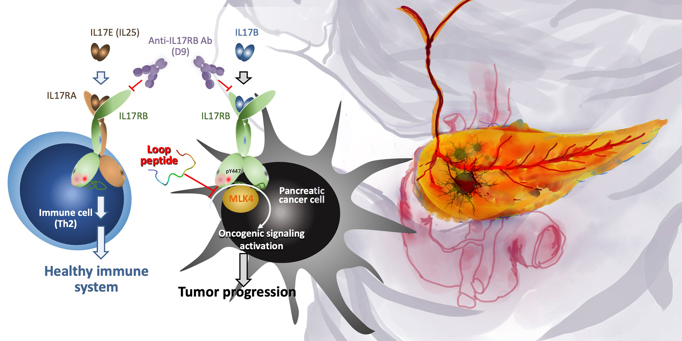 Pancreatic Cancer Cell Escaping Blueprint Brings Hope to Ease Metastasis